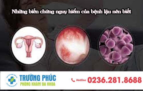 Những biến chứng nguy hiểm của bệnh lậu nên biết