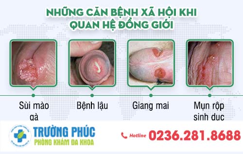 Những căn bệnh xã hội tiềm ẩn trong mối quan hệ đồng giới