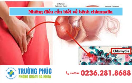 Những điều cần biết về bệnh chlamydia