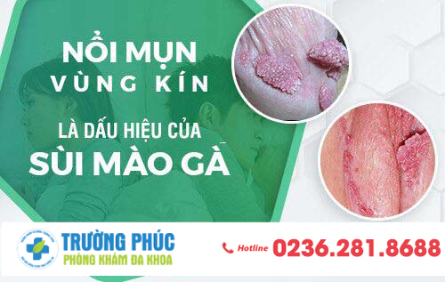 Nổi mụn vùng kín dấu hiệu nguy hiểm từ bệnh sùi mào gà
