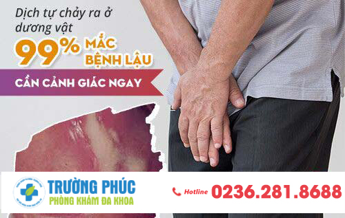 5 dấu hiệu của bệnh lậu ở nam giới