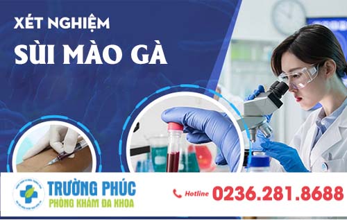 PHƯƠNG PHÁP XÉT NGHIỆM SÙI MÀO GÀ CHÍNH XÁC NHANH CHÓNG NHẤT