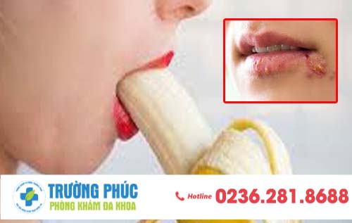 Quan hệ bằng miệng có lây bệnh lậu không?