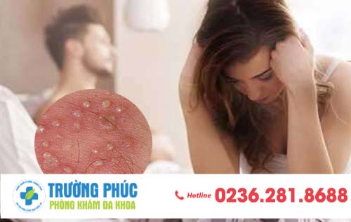 Quan hệ với người lạ và nguy cơ mắc bệnh xã hội như thế nào?