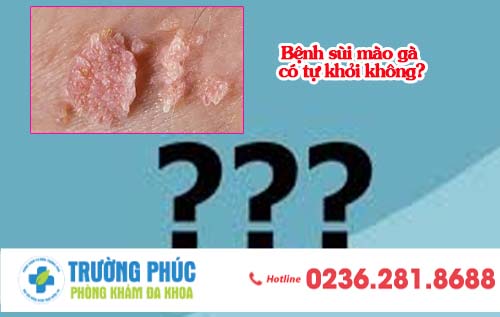 Bệnh sùi mào gà có tự khỏi không?