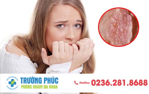 Tìm hiểu về bệnh sùi mào gà ở âm đạo