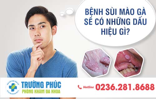 Bệnh sùi mào gà sẽ có những dấu hiệu gì?