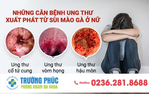 Tại sao sùi mào gà ở nữ lại là “điểm tựa” của những căn bệnh ung thư?