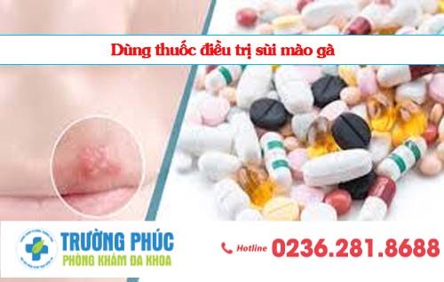 Hỗ trợ điều trị sùi mào gà bằng thuốc tại Đà Nẵng