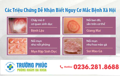 Các triệu chứng của bệnh xã hội dễ nhận biết nhất