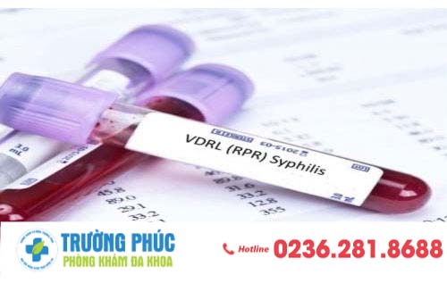 Phương pháp xét nghiệm bệnh giang mai chính xác