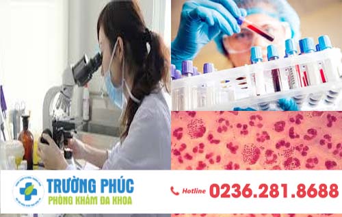 Các phương pháp xét nghiệm bệnh lậu mới hiện nay