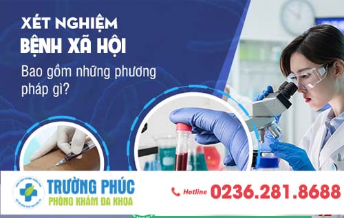 Xét nghiệm bệnh xã hội chi phí bao nhiêu? Thực hiện ở đâu uy tín?