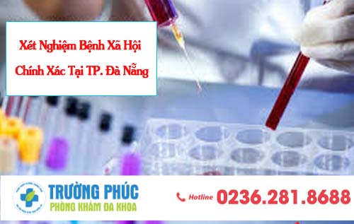 Chi phí xét nghiệm bệnh xã hội rẻ  là bao nhiêu?