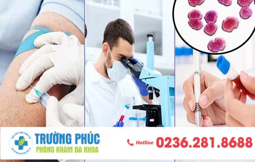 5 cách xét nghiệm bệnh lậu chính xác hiện nay