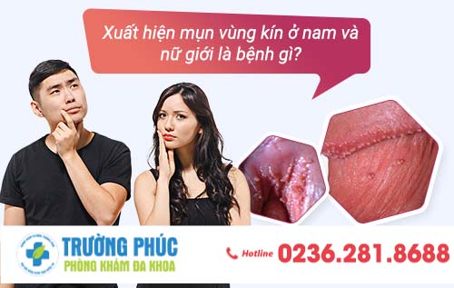 Xuất hiện mụn vùng kín ở nam và nữ giới là bệnh gì?